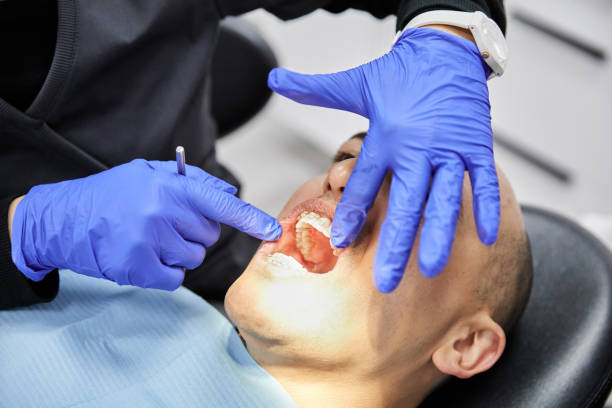 Best Chipped Tooth Repair Near Me  in Big Sky, MT